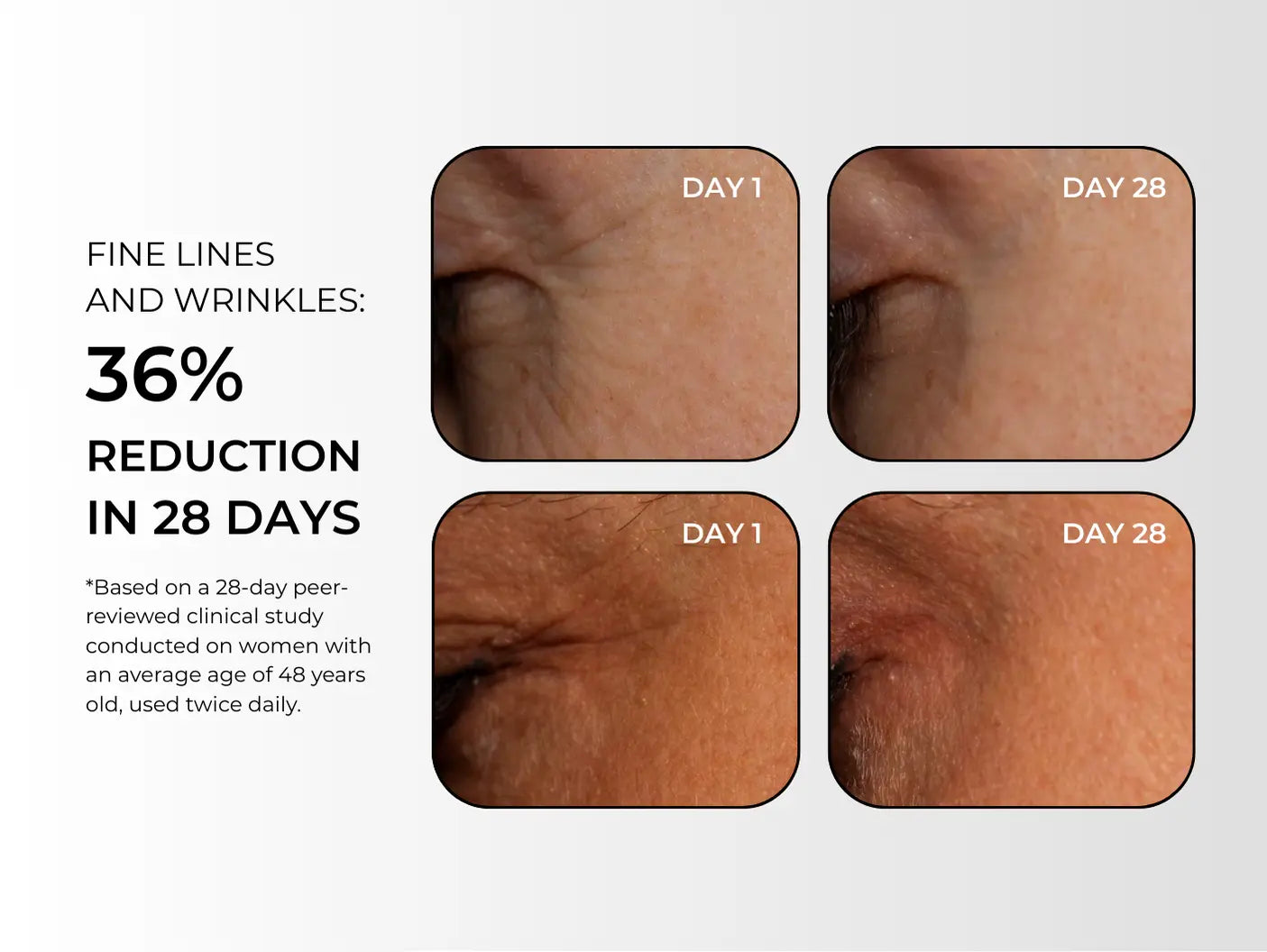 FINE LINES AND WRINKLES 32% REDUCTION IN 28 DAYS (3).webp__PID:e70f0108-4b20-4495-9d86-efe76a7ceeb3