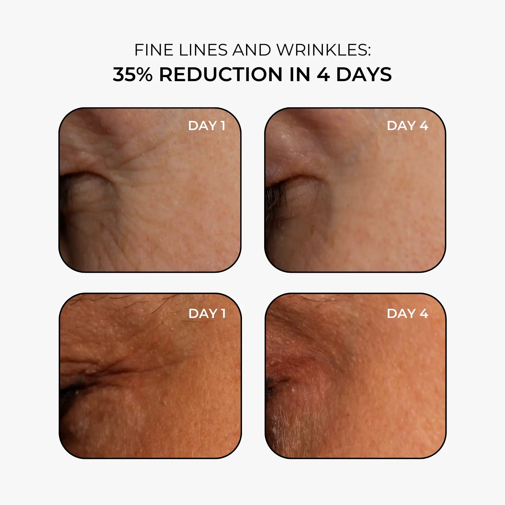 Youth Revealed™ Face